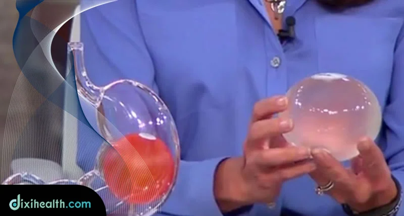 gastric balloon treatment in turkey istanbul