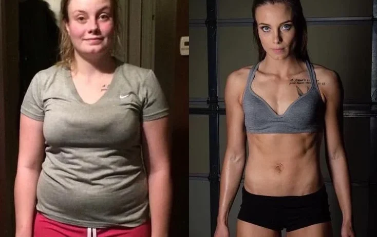 liposuction-surgery-before-after