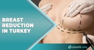 Breast Reduction in Istanbul Turkey