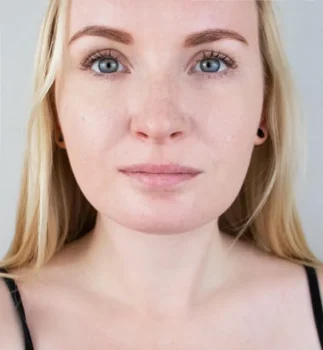 Double Chin Surgery Price Turkey Istanbul Before After