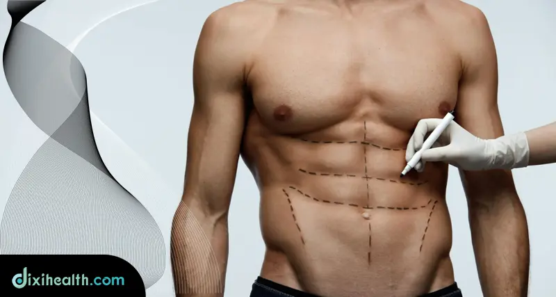 Male Abdominal Etching in Turkey Istanbul