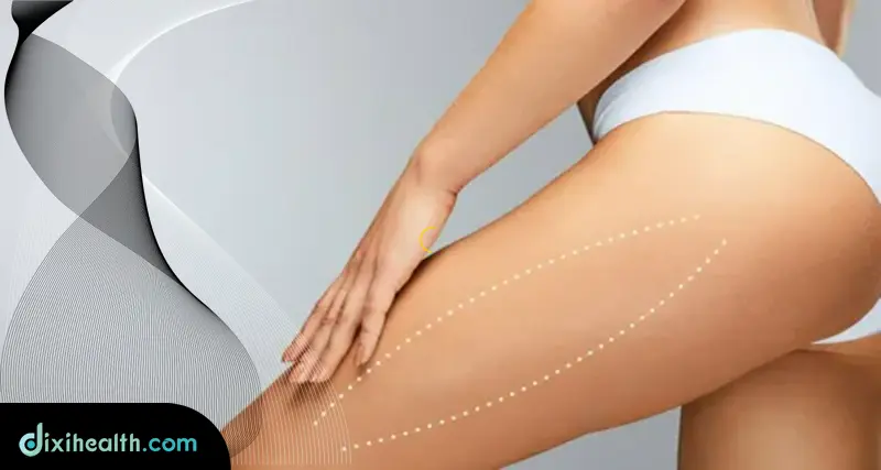 Thigh Lift Surgery in Istanbul Turkey