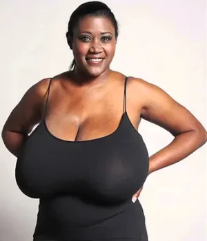 breast reduction turkey cost before after breast reduction turkey cost before after