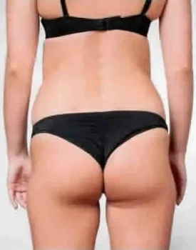butt lift surgery cost turkey before after butt lift surgery cost turkey before after