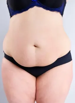 tummy tuck before tummy tuck before