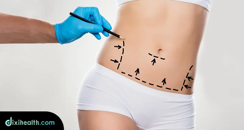 tummy tuck in turkey istanbul turkey
