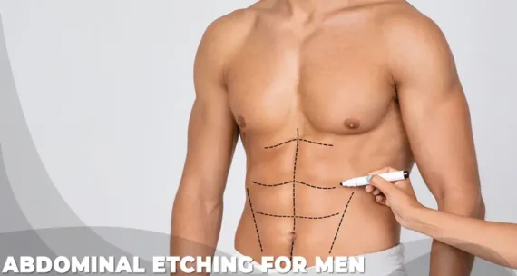 Abdominal etching for men