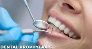 Dental Prophylaxis Treatment