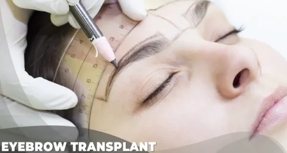 9 Eyebrow Transplant e1705931912322 Eyebrow Lifting Surgery Eyebrow Transplant