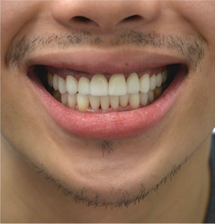 Periodontics After