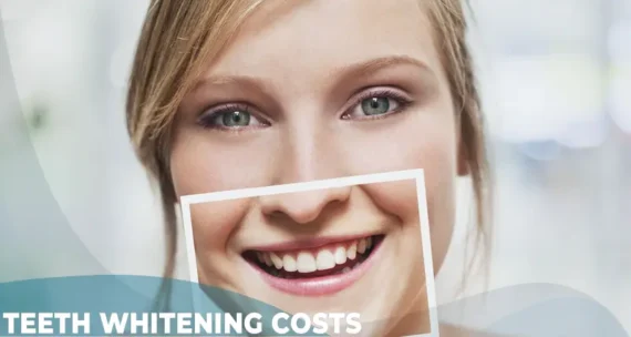 Teeth Whitening costs