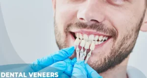 dental veneers istanbul cost and price