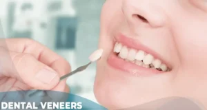 dental veneers turkey