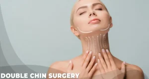 3 double chin surgery double chin surgery cost turkey