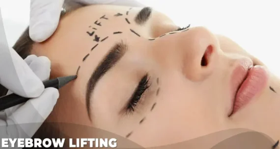eyebrow lifting cost turkey