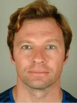 hair transplantation istanbul cost before after