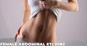 Female Abdominal Etching Cost in Turkey