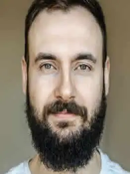 beard transplant price before after