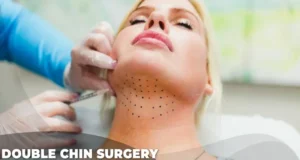 2 double chin surgery cost turkey double chin surgery cost turkey