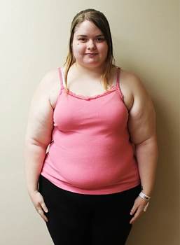 gastric band surgery cost in turkey before after gastric band surgery cost in turkey before after