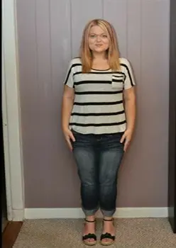 gastric bypass price in turkey before after