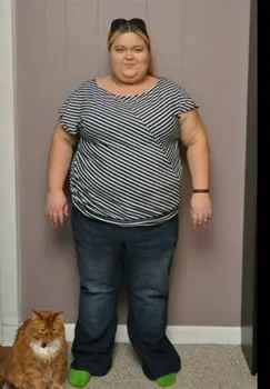 gastric bypass cost in turkey before after gastric bypass cost in turkey before after