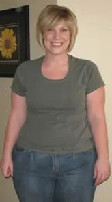 mini gastric bypass before 3