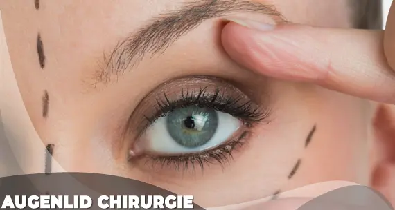 Augenlid Chirurgie Kosten Türkei Istanbul ab Augenlid Chirurgie Kosten Türkei Istanbul ab