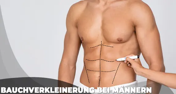 Bauchverkleinerung bei Männern Kosten in der Türkei Istanbul