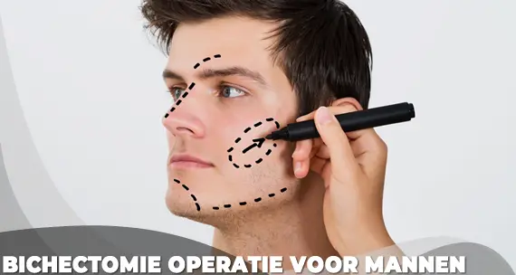 Bichectomie operatie voor mannen Turkije