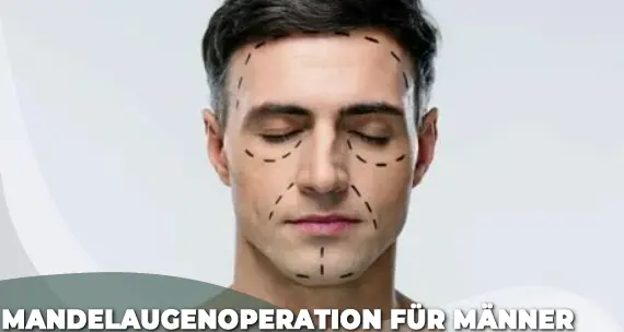 Mandel-Augen-OP-Kosten für Männer in der Türkei