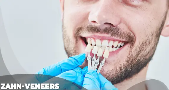 Zahn-Veneers kosten in der türkei ab