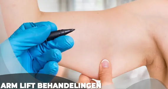 arm lift behandelingen