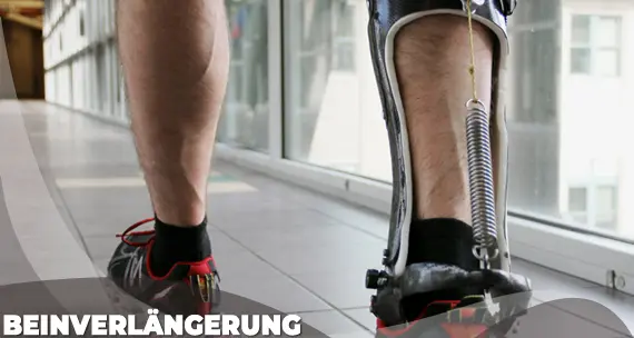 Beinverlängerung Op preise kosten istanbul türkei ab