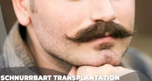 14 Schnurrbart Transplantation kosten istanbul turkei ab Schnurrbart Transplantation kosten istanbul türkei ab
