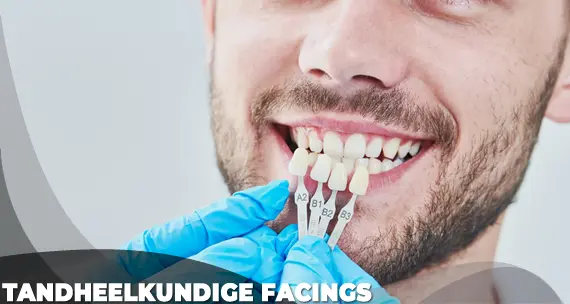 Tandheelkundige Facings